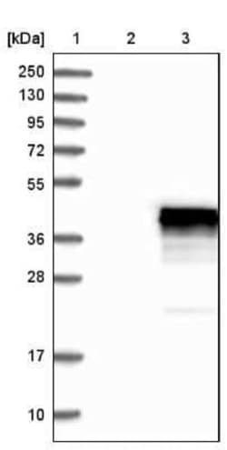 CDCA3 Antibody, Novus Biologicals 25 &mu;L | Buy Online | Novus Biologicals | Fisher Scientific