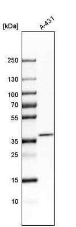 CDCA3 Antibody, Novus Biologicals 25 &mu;L | Buy Online | Novus Biologicals | Fisher Scientific