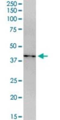 CDCA5 Antibody, Novus Biologicals 0.05 mg | Buy Online | Novus Biologicals | Fisher Scientific