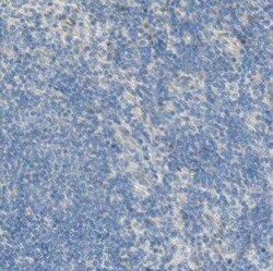 CDCP1 Antibody, Novus Biologicals 0.1 mL | Buy Online | Novus Biologicals | Fisher Scientific