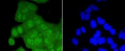 CDK2 Rabbit anti-Human, Clone: SR01-01, Novus Biologicals 100&mu;L:Antibodies,