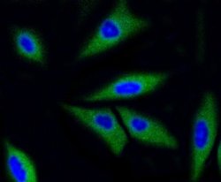 CDK2 Rabbit anti-Human, Clone: SR01-01, Novus Biologicals 100&mu;L:Antibodies,