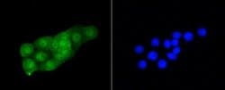 CDK2 Rabbit anti-Human, Clone: SR01-01, Novus Biologicals 100&mu;L:Antibodies,