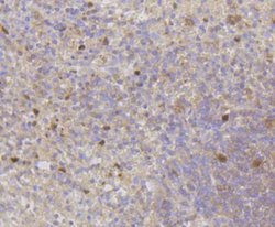CDK2 Rabbit anti-Human, Clone: SR01-01, Novus Biologicals 100&mu;L:Antibodies,