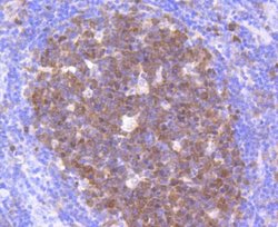 CDK2 Rabbit anti-Human, Clone: SR01-01, Novus Biologicals 100&mu;L:Antibodies,