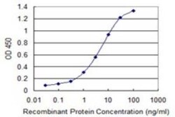 CDK20 Antibody (3E11), Novus Biologicals 0.1 mg | Buy Online | Novus Biologicals | Fisher Scientific