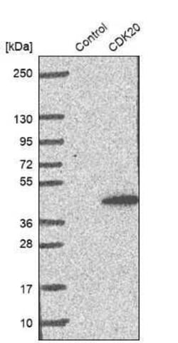 CDK20 Antibody, Novus Biologicals 0.1 mL; Unconjugated:Antibodies, Polyclonal