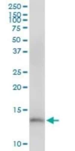 CDK2AP2 Antibody, Novus Biologicals 0.05 mg | Buy Online | Novus Biologicals | Fisher Scientific