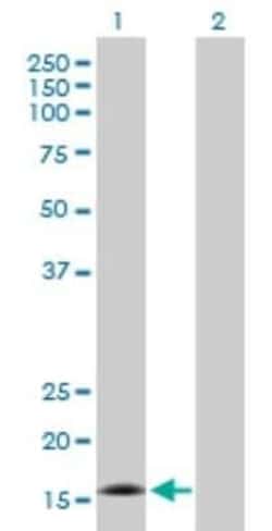 CDK2AP2 Antibody, Novus Biologicals 0.05 mg | Buy Online | Novus Biologicals | Fisher Scientific