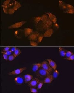 CDK4 Rabbit anti-Human, Mouse, Rat, Clone: 3G7Q7, Novus Biologicals 100