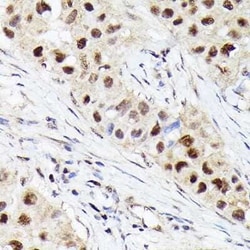 CDK4 Rabbit anti-Human, Mouse, Rat, Clone: 3G7Q7, Novus Biologicals 100
