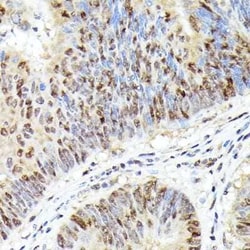 CDK4 Rabbit anti-Human, Mouse, Rat, Clone: 3G7Q7, Novus Biologicals 100