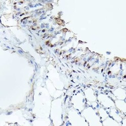 CDK4 Rabbit anti-Human, Mouse, Rat, Clone: 3G7Q7, Novus Biologicals 100