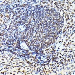 CDK4 Rabbit anti-Human, Mouse, Rat, Clone: 3G7Q7, Novus Biologicals 100
