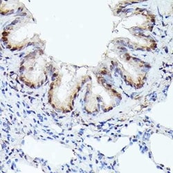 CDK4 Rabbit anti-Human, Mouse, Rat, Clone: 3G7Q7, Novus Biologicals 100