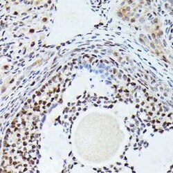 CDK4 Rabbit anti-Human, Mouse, Rat, Clone: 3G7Q7, Novus Biologicals 100