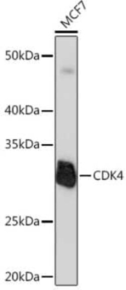 CDK4 Rabbit anti-Human, Mouse, Rat, Clone: 3G7Q7, Novus Biologicals 100