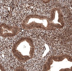 CDK4 Antibody (CL8102), Novus Biologicals 100 &mu;L | Buy Online | Novus Biologicals | Fisher Scientific