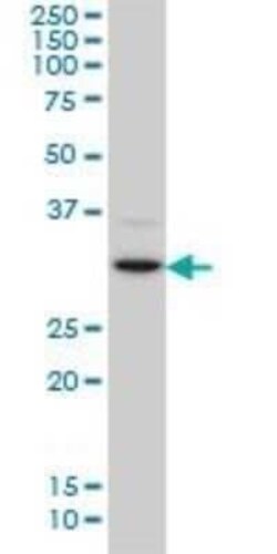 CDK4 Antibody (4F11), Novus Biologicals 0.1 mg | Buy Online | Novus Biologicals | Fisher Scientific