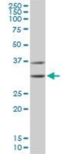 CDK4 Antibody (4F11), Novus Biologicals 0.1 mg | Buy Online | Novus Biologicals | Fisher Scientific