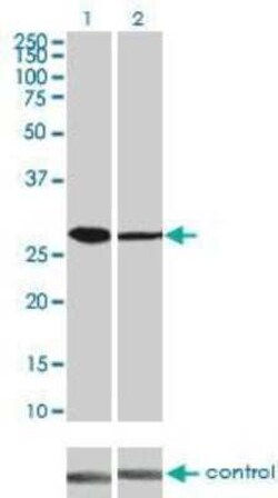 CDK4 Antibody (4F11), Novus Biologicals 0.1 mg | Buy Online | Novus Biologicals | Fisher Scientific