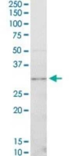 CDK4 Antibody (4F11), Novus Biologicals 0.1 mg | Buy Online | Novus Biologicals | Fisher Scientific