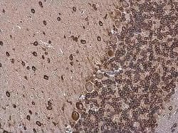 CDK5 Activator 1 Antibody, Novus Biologicals 100 &mu;g; Unconjugated:Antibodies,