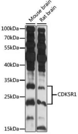 CDK5 Activator 1 Antibody - Azide and BSA Free, Novus Biologicals 0.1 mL,