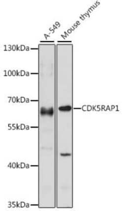 CDK5RAP1 Antibody - Azide and BSA Free, Novus Biologicals 0.02 mL, Unconjugated:Antibodies,