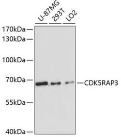 CDK5RAP3 Antibody - Azide and BSA Free, Novus Biologicals 0.1 mL, Unconjugated:Antibodies,