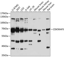 CDK5RAP3 Antibody - Azide and BSA Free, Novus Biologicals 0.02 mL | Buy Online | Novus Biologicals | Fisher Scientific
