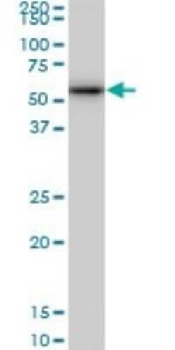 CDK8 Antibody (5H4), Novus Biologicals 0.1 mg | Buy Online | Novus Biologicals | Fisher Scientific