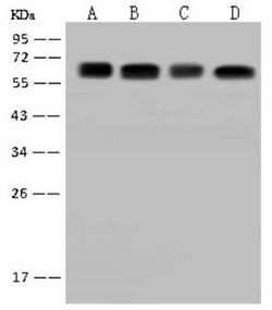 CDKAL1 Antibody, Novus Biologicals 50 &mu;g, Unconjugated:Antibodies, Polyclonal