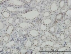 CDKL1 Antibody (1F12), Novus Biologicals 0.1 mg | Buy Online | Novus Biologicals | Fisher Scientific