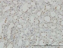 CDKL1 Antibody (5B11), Novus Biologicals 0.1 mg | Buy Online | Novus Biologicals | Fisher Scientific