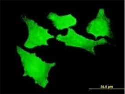 CDKL2 Antibody (1F6), Novus Biologicals 0.1 mg | Buy Online | Novus Biologicals | Fisher Scientific