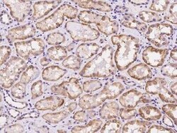 CDKL4 Antibody, Novus Biologicals:Antibodies:Primary Antibodies