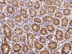 CDKL4 Antibody, Novus Biologicals:Antibodies:Primary Antibodies