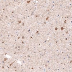 CDKL5 Antibody (CL4881), Novus Biologicals:Antibodies:Primary Antibodies