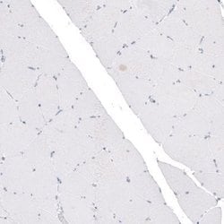 CDKL5 Antibody (CL4881), Novus Biologicals:Antibodies:Primary Antibodies