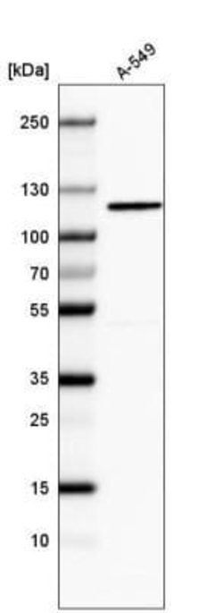 CDKL5 Antibody (CL4881), Novus Biologicals:Antibodies:Primary Antibodies