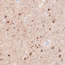 CDKL5 Antibody (CL4888), Novus Biologicals 25 &mu;L:Antibodies, Monoclonal
