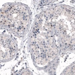 CDKL5 Antibody (CL4888), Novus Biologicals 25 &mu;L:Antibodies, Monoclonal