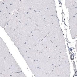 CDKL5 Antibody (CL4888), Novus Biologicals 25 &mu;L:Antibodies, Monoclonal