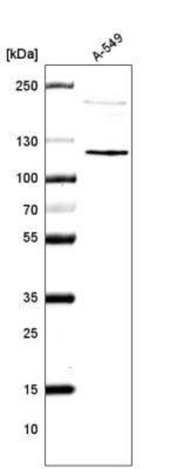 CDKL5 Antibody (CL4888), Novus Biologicals 25 &mu;L:Antibodies, Monoclonal