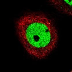 CDP/CUTL1 Antibody (CL5278), Novus Biologicals:Antibodies:Primary Antibodies