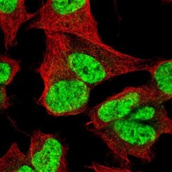 CDP/CUTL1 Antibody (CL5278), Novus Biologicals:Antibodies:Primary Antibodies
