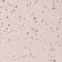 CDP/CUTL1 Antibody (CL5278), Novus Biologicals:Antibodies:Primary Antibodies