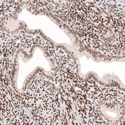 CDP/CUTL1 Antibody (CL5278), Novus Biologicals:Antibodies:Primary Antibodies