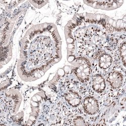 CDP/CUTL1 Antibody (CL5278), Novus Biologicals:Antibodies:Primary Antibodies